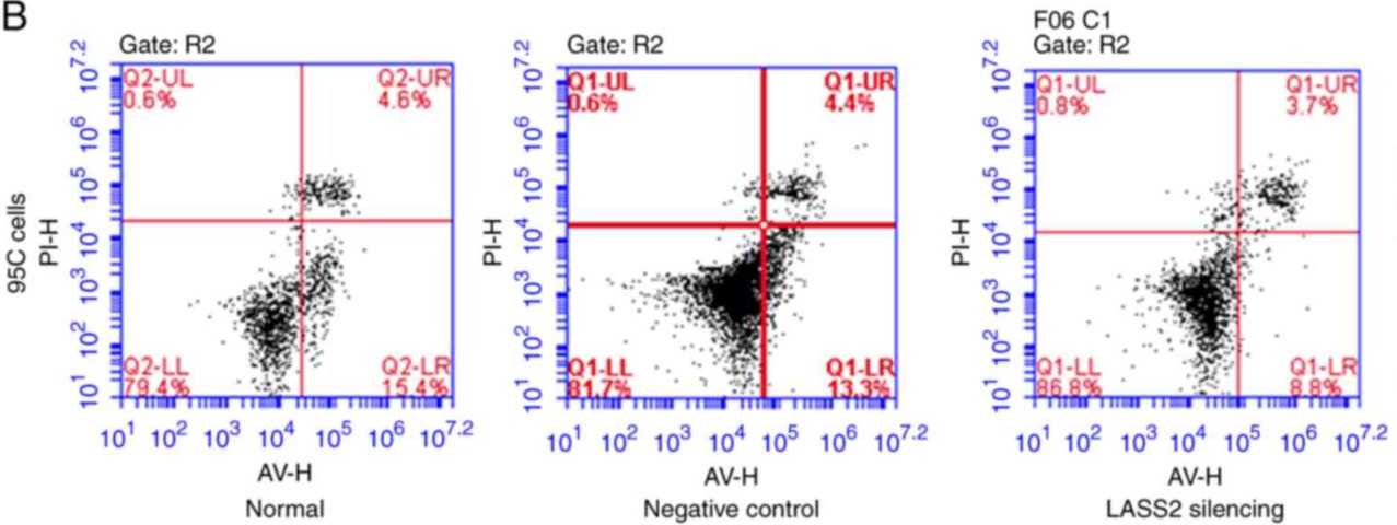 The effect of silencing of LASS2 on the apoptosis of 95C cells.jpg